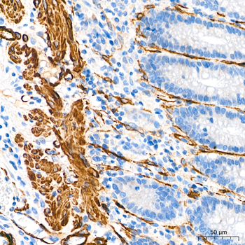 α-Smooth Muscle Actin (ACTA2) Rabbit pAb Antibody