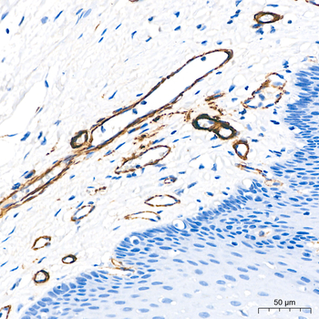 α-Smooth Muscle Actin (ACTA2) Rabbit pAb Antibody