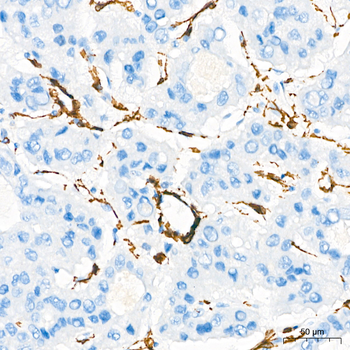 α-Smooth Muscle Actin (ACTA2) Rabbit pAb Antibody