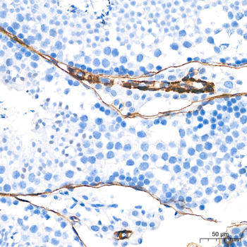 α-Smooth Muscle Actin (ACTA2) Rabbit pAb Antibody