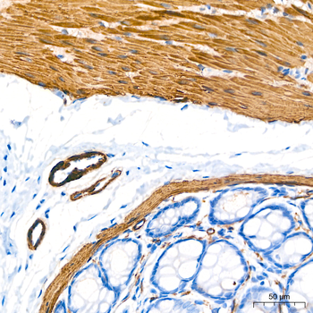 α-Smooth Muscle Actin (ACTA2) Rabbit pAb Antibody