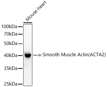 α-Smooth Muscle Actin (ACTA2) Rabbit pAb Antibody