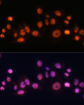 EFTUD2 Rabbit pAb Antibody