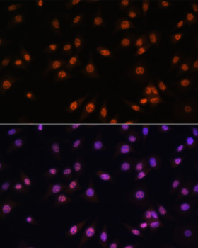 EFTUD2 Rabbit pAb Antibody