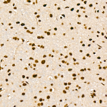 EFTUD2 Rabbit pAb Antibody