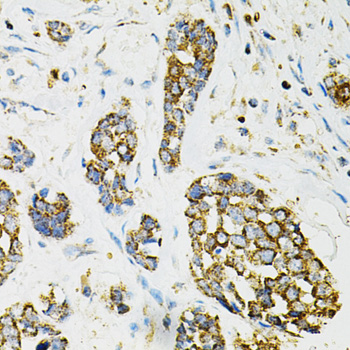 ADSS Rabbit pAb Antibody