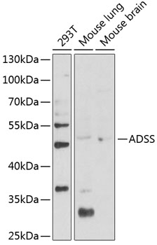 ADSS Rabbit pAb Antibody