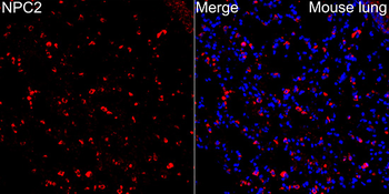 NPC2 Rabbit pAb Antibody