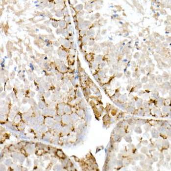 NPC2 Rabbit pAb Antibody