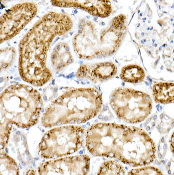 NPC2 Rabbit pAb Antibody