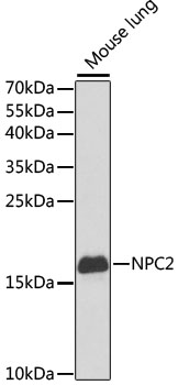 NPC2 Rabbit pAb Antibody