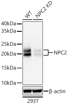 NPC2 Rabbit pAb Antibody