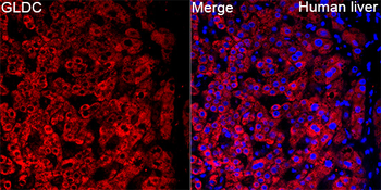 GLDC Rabbit pAb Antibody