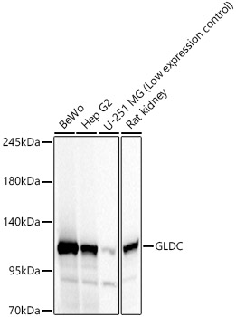 GLDC Rabbit pAb Antibody