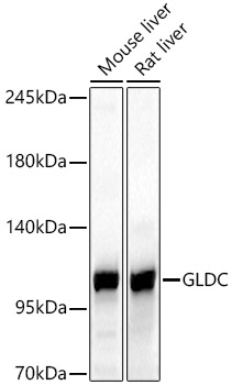 GLDC Rabbit pAb Antibody