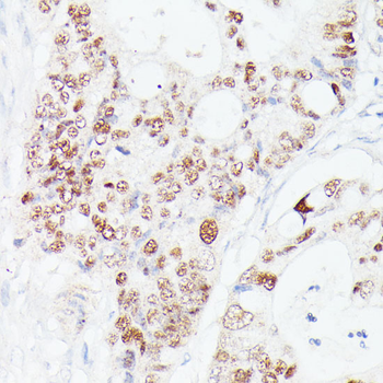 p53 Rabbit pAb Antibody