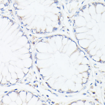 p53 Rabbit pAb Antibody