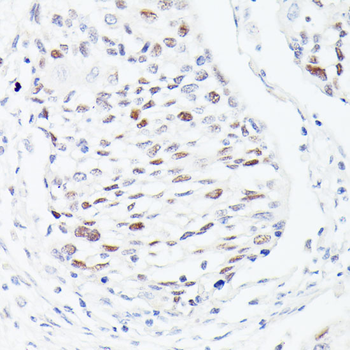 p53 Rabbit pAb Antibody