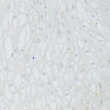 p53 Rabbit pAb Antibody