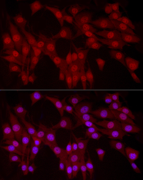 YAP1 Rabbit pAb Antibody