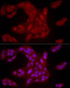 YAP1 Rabbit pAb Antibody