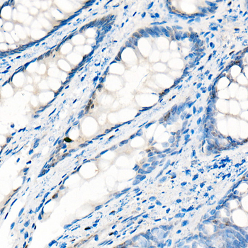 YAP1 Rabbit pAb Antibody