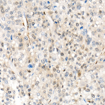 YAP1 Rabbit pAb Antibody