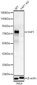 YAP1 Rabbit pAb Antibody