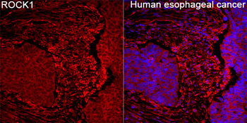 ROCK1 Rabbit pAb Antibody