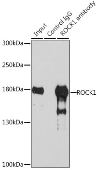 ROCK1 Rabbit pAb Antibody