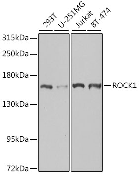 ROCK1 Rabbit pAb Antibody