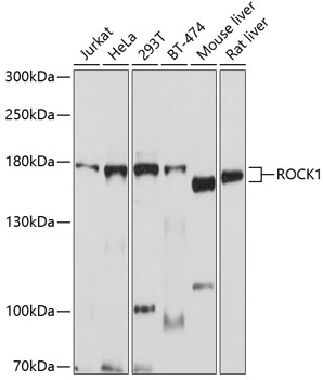 ROCK1 Rabbit pAb Antibody