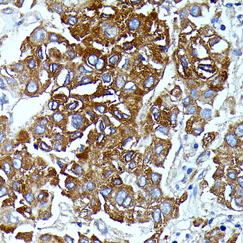 IL13RA2 antibody