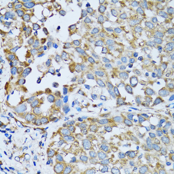 RARS antibody