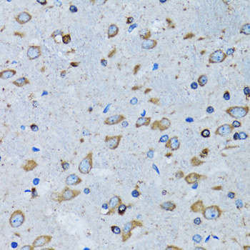 RARS antibody