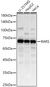 RARS antibody