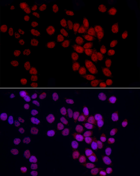 YEATS4 antibody