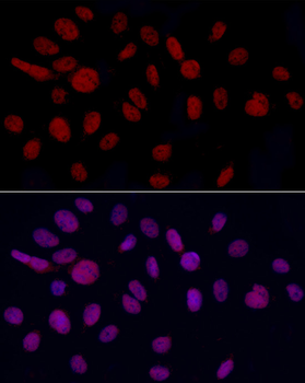 YEATS4 antibody