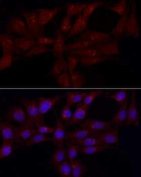 GRP antibody