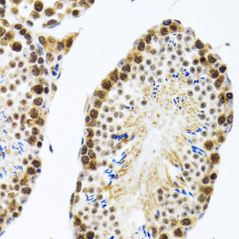 CIRBP antibody