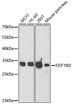 EEF1B2 antibody