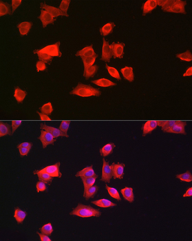 GAMT antibody