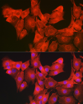 GAMT antibody