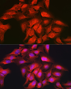 GAMT antibody