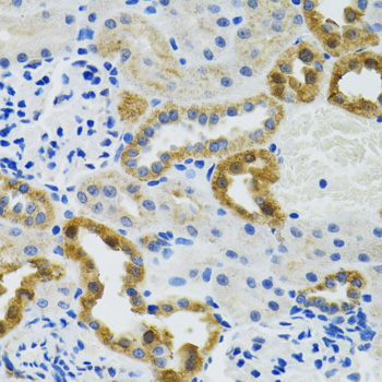 POLG2 antibody