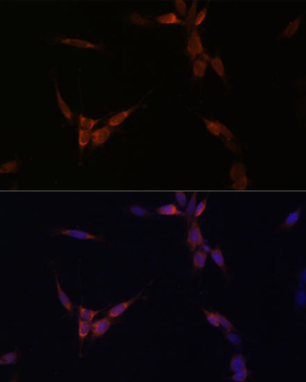 PPP2CA antibody