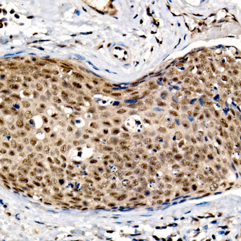 PPP2CA antibody