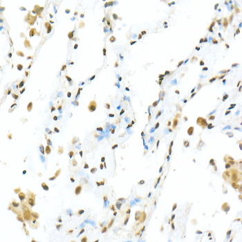 TEAD1 antibody