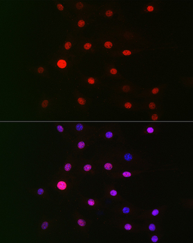 GPS1 antibody