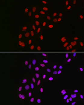 GPS1 antibody